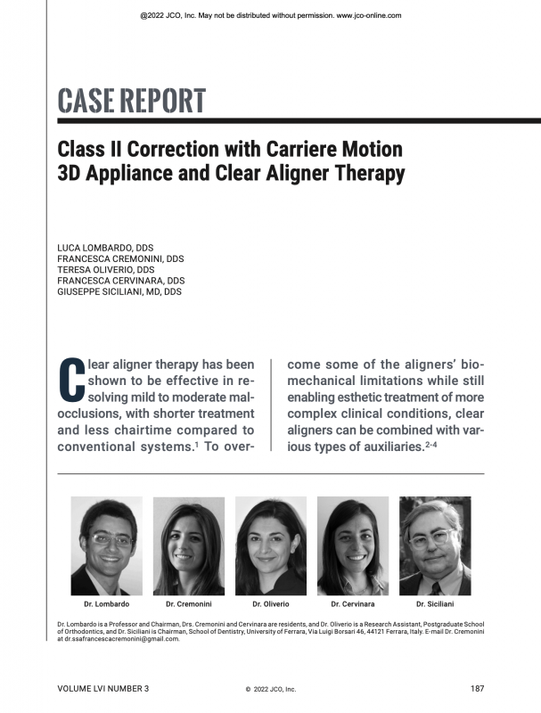 CASE REPORT Class II Correction with Carriere Motion 3D Appliance and Clear Aligner Therapy1